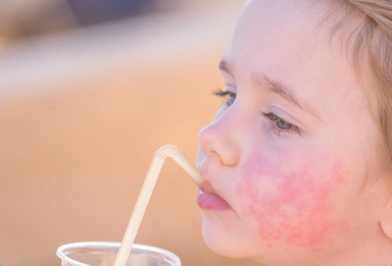 Child health immunity